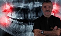 Yirmilik Dişler İhmale Gelmiyor! Uzmanı Uyardı: Gülüşünüz Bozulabilir