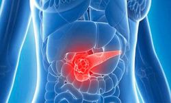 Uzmanı Pankreas Kanserine Karşı Uyardı: "Artan Sigara Kullanımı Riski Yükseltiyor"