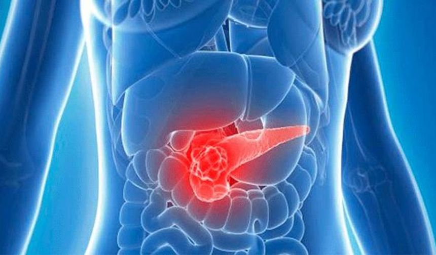 Uzmanı Pankreas Kanserine Karşı Uyardı: "Artan Sigara Kullanımı Riski Yükseltiyor"