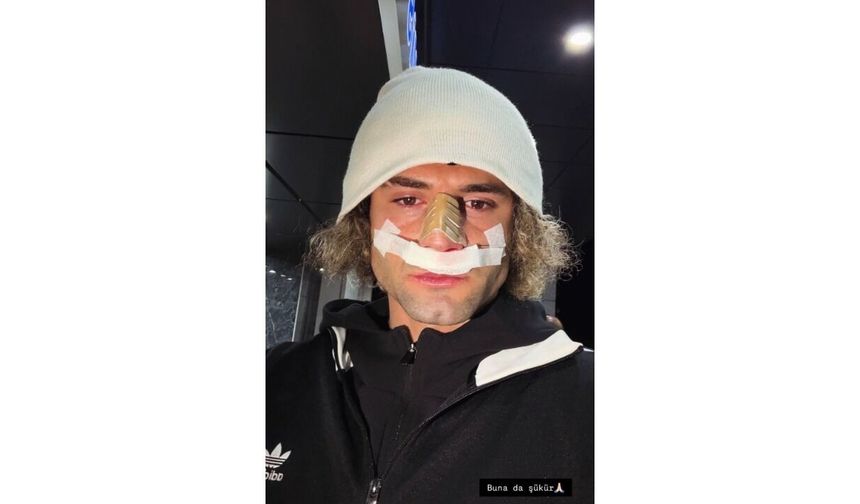 Elazığspor'da Fuat Bavuk'un Burnu Kırıldı