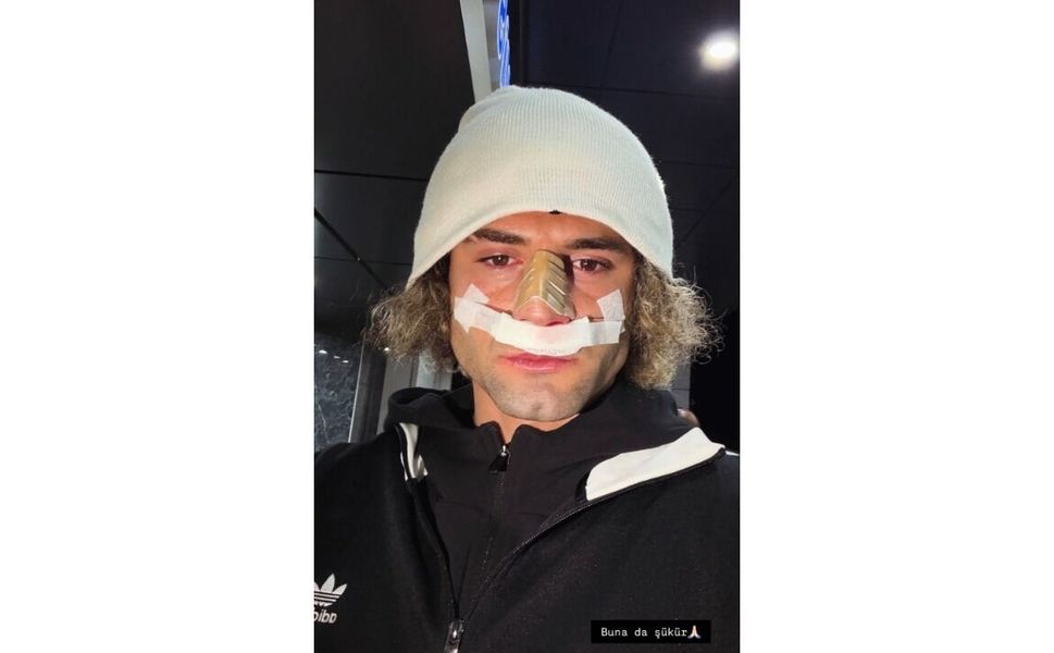 Elazığspor'da Fuat Bavuk'un Burnu Kırıldı